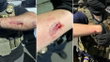 Anti-ICE agitator charged with allegedly biting officers during Delaney Hall clashes