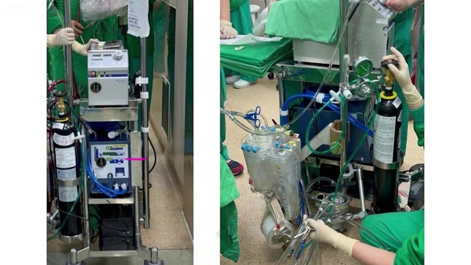 World's first continuous beating heart transplant